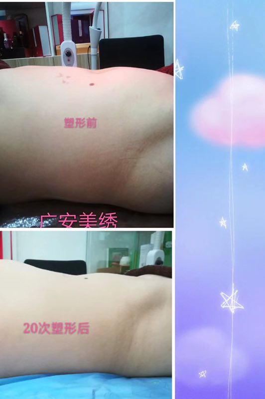 使用我司产品塑形前后对比