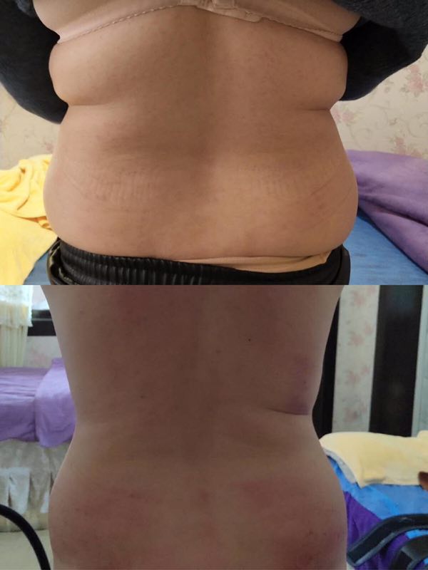 产品效果展示—腰部