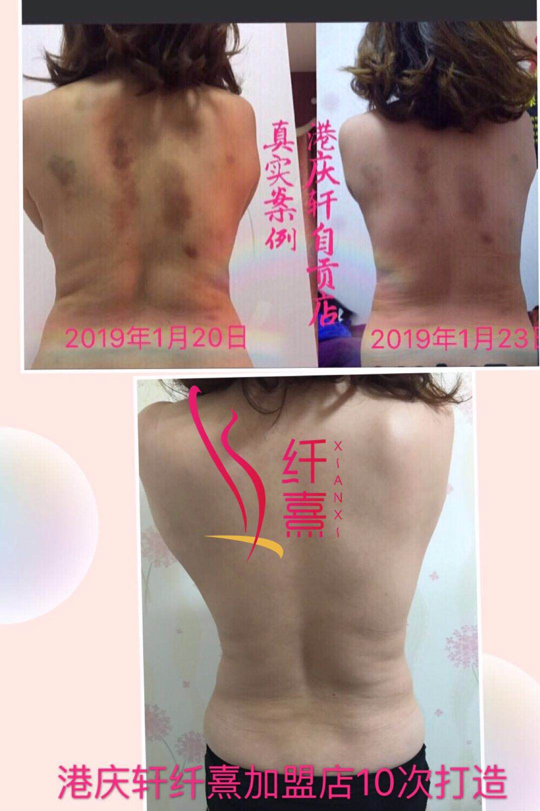 港庆轩纤熹加盟店10次效果图