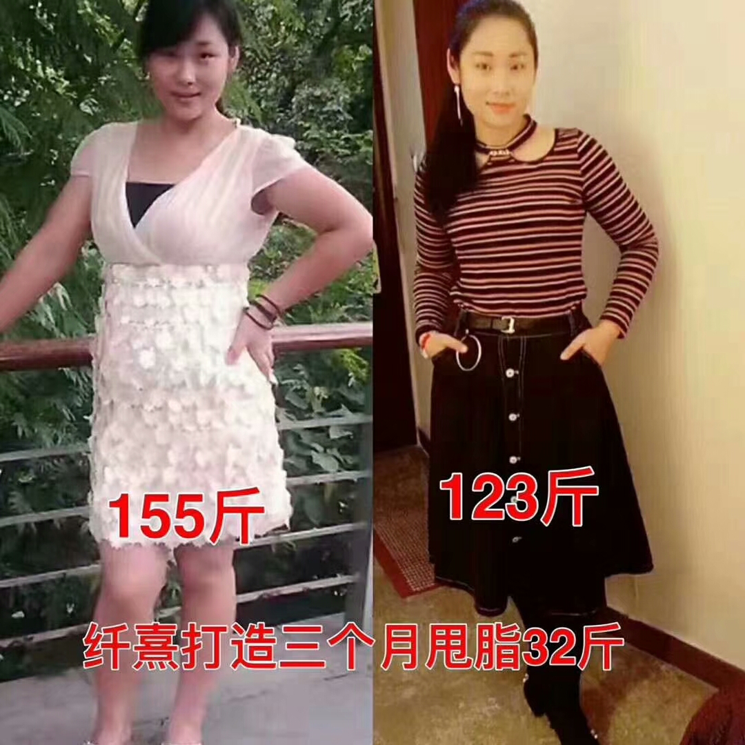 纤熹效果展示---全身